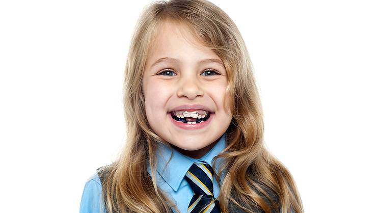 Braces for kids — yes or no?