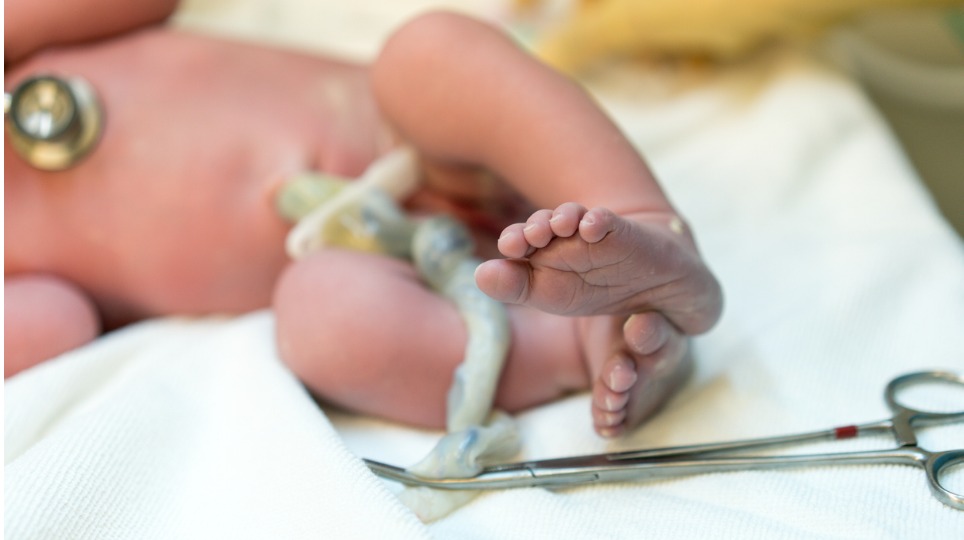 Newborn with umbilical cord