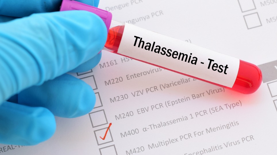 Thalassemia