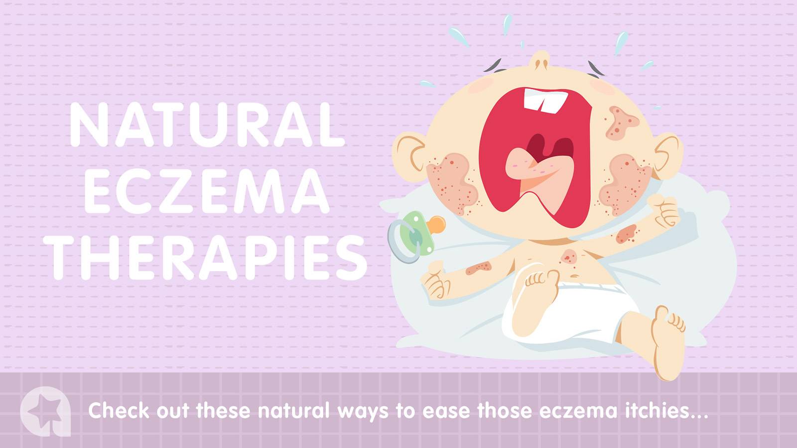 Babies--7-natural-eczema-remedies-to-try-main
