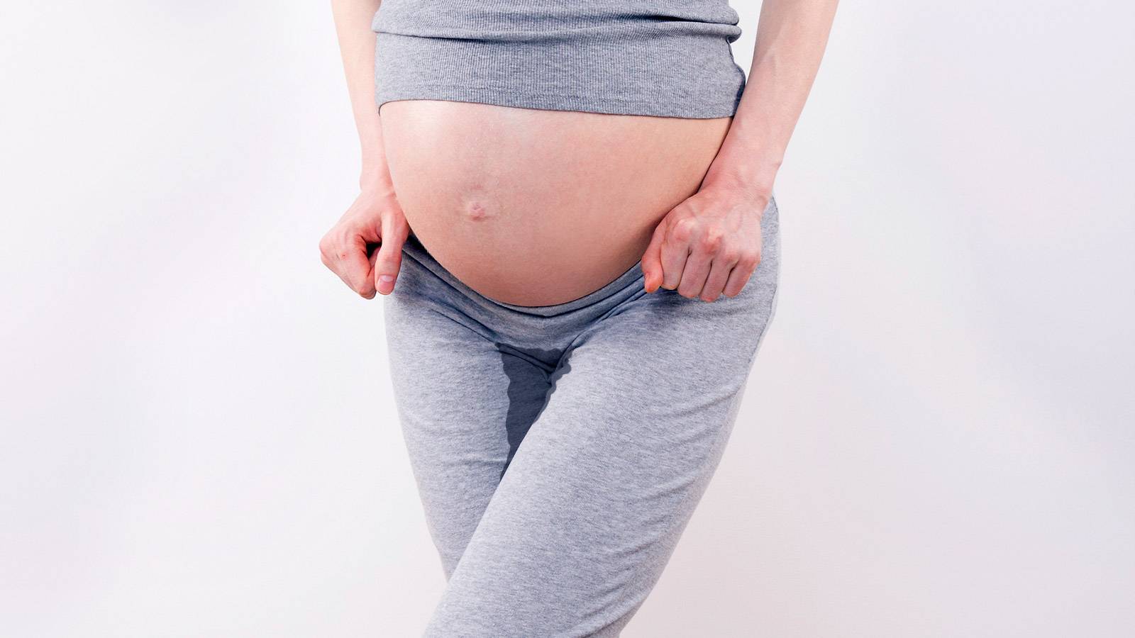 The kind of urinary incontinence a woman experiences during pregnancy is us...