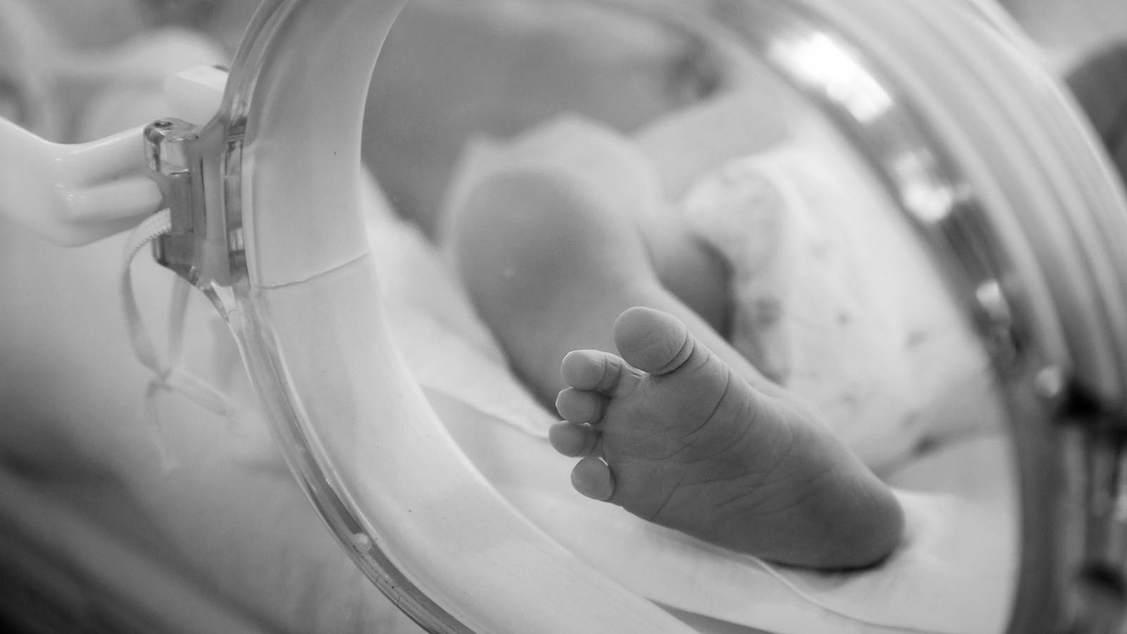 Babies-5-scary-birthing-injuries-newborns-face-1