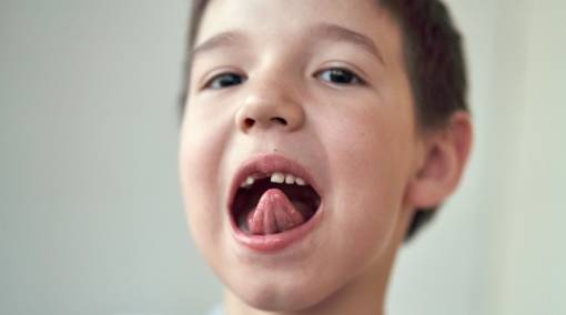 How to handle your kid's dental injuries