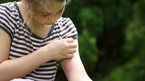 Kids- 7 home remedies to treat junior's mosquito bites-1