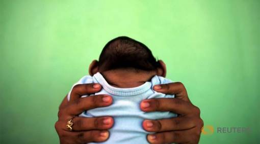 Pregnancy--Pregnancy-Zika-4-facts-to-know-about-microcephaly-2